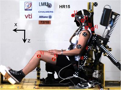 Dynamic Responses of Female Volunteers in Rear Impact Sled Tests at Two Head Restraint Distances